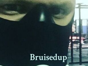 Bruisedup